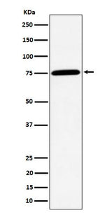 Anti-PPM1G Rabbit Monoclonal Antibody Boster Bio