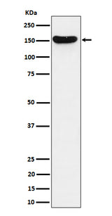 Anti-HDLBP Rabbit Monoclonal Antibody Boster Bio