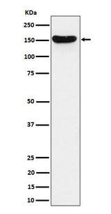 Anti-HDLBP Rabbit Monoclonal Antibody Boster Bio