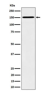 Anti-HDLBP Rabbit Monoclonal Antibody Boster Bio