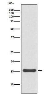 Anti-SUMO4 Rabbit Monoclonal Antibody Boster Bio