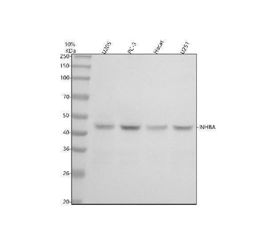 Anti-Inhibin beta A Rabbit Monoclonal Antibody Boster Bio
