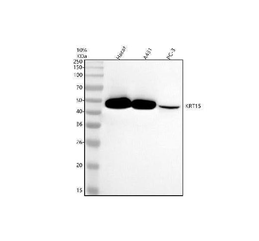 Anti-Cytokeratin 15 Rabbit Monoclonal Antibody Boster Bio