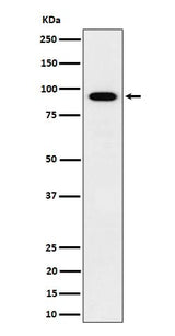 Anti-IFT88 Rabbit Monoclonal Antibody Boster Bio