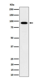 Anti-IFT88 Rabbit Monoclonal Antibody Boster Bio