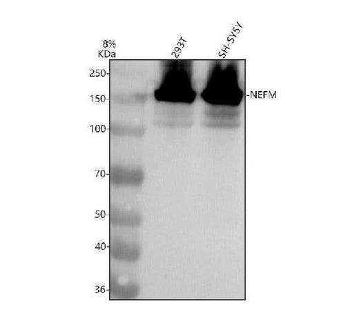 Anti-NEFM/Nf M Rabbit Monoclonal Antibody Boster Bio