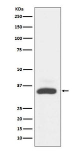 Anti-MAD2L1BP/Mad2L1 Binding Protein Rabbit Monoclonal Antibody Boster Bio