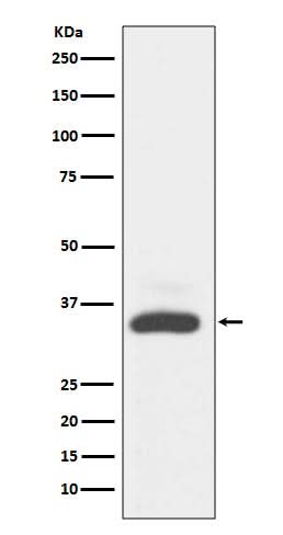 Anti-MAD2L1BP/Mad2L1 Binding Protein Rabbit Monoclonal Antibody Boster Bio