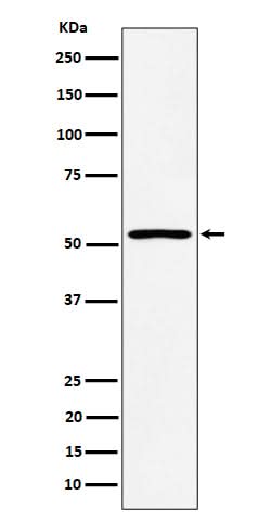 Anti-SAMM50 Rabbit Monoclonal Antibody Boster Bio