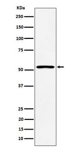 Anti-SAMM50 Rabbit Monoclonal Antibody Boster Bio