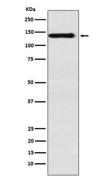 Anti-Integrin alpha 9 Rabbit Monoclonal Antibody Boster Bio