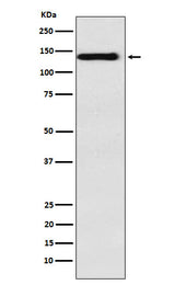 Anti-Integrin alpha 9 Rabbit Monoclonal Antibody Boster Bio