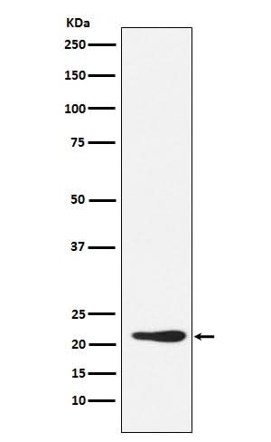Anti-GDF3 Rabbit Monoclonal Antibody Boster Bio