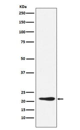 Anti-GDF3 Rabbit Monoclonal Antibody Boster Bio