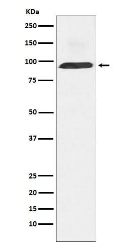 Anti-Dynamin 3 Rabbit Monoclonal Antibody Boster Bio