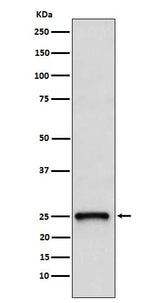 Anti-TC10 Rabbit Monoclonal Antibody Boster Bio