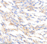 Anti-PTPRR Rabbit Monoclonal Antibody Boster Bio