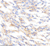 Anti-PTPRR Rabbit Monoclonal Antibody Boster Bio
