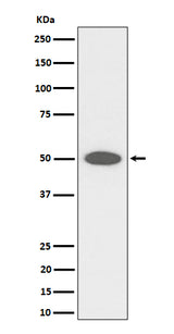 Anti-CEP43 Rabbit Monoclonal Antibody Boster Bio