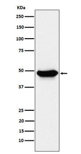 Anti-ENTPD5 Rabbit Monoclonal Antibody Boster Bio