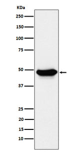Anti-ENTPD5 Rabbit Monoclonal Antibody Boster Bio