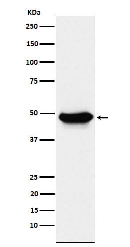 Anti-ENTPD5 Rabbit Monoclonal Antibody Boster Bio