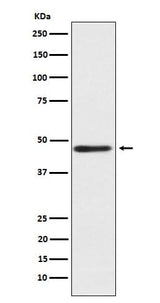 Anti-ENTPD5 Rabbit Monoclonal Antibody Boster Bio