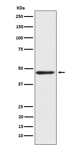 Anti-ENTPD5 Rabbit Monoclonal Antibody Boster Bio
