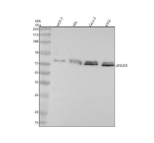 Anti-ZNF259 Rabbit Monoclonal Antibody Boster Bio