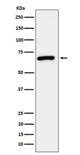 Anti-USP39 Rabbit Monoclonal Antibody Boster Bio