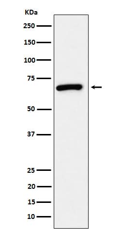 Anti-USP39 Rabbit Monoclonal Antibody Boster Bio