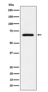 Anti-USP39 Rabbit Monoclonal Antibody Boster Bio