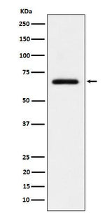 Anti-USP39 Rabbit Monoclonal Antibody Boster Bio