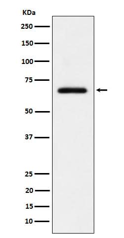 Anti-USP39 Rabbit Monoclonal Antibody Boster Bio