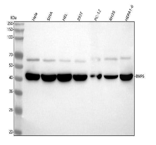 Anti-BMP6 Rabbit Monoclonal Antibody Boster Bio