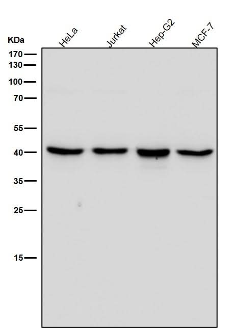 Anti-ALKBH1 Rabbit Monoclonal Antibody Boster Bio