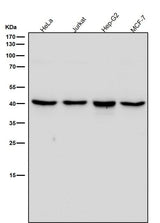 Anti-ALKBH1 Rabbit Monoclonal Antibody Boster Bio
