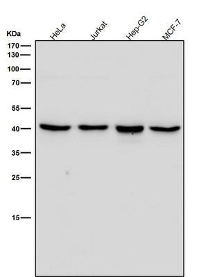 Anti-ALKBH1 Rabbit Monoclonal Antibody Boster Bio