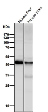 Anti-ALKBH1 Rabbit Monoclonal Antibody Boster Bio