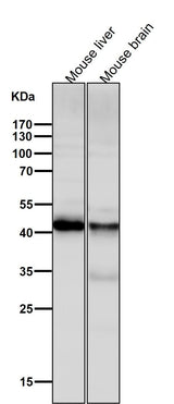 Anti-ALKBH1 Rabbit Monoclonal Antibody Boster Bio