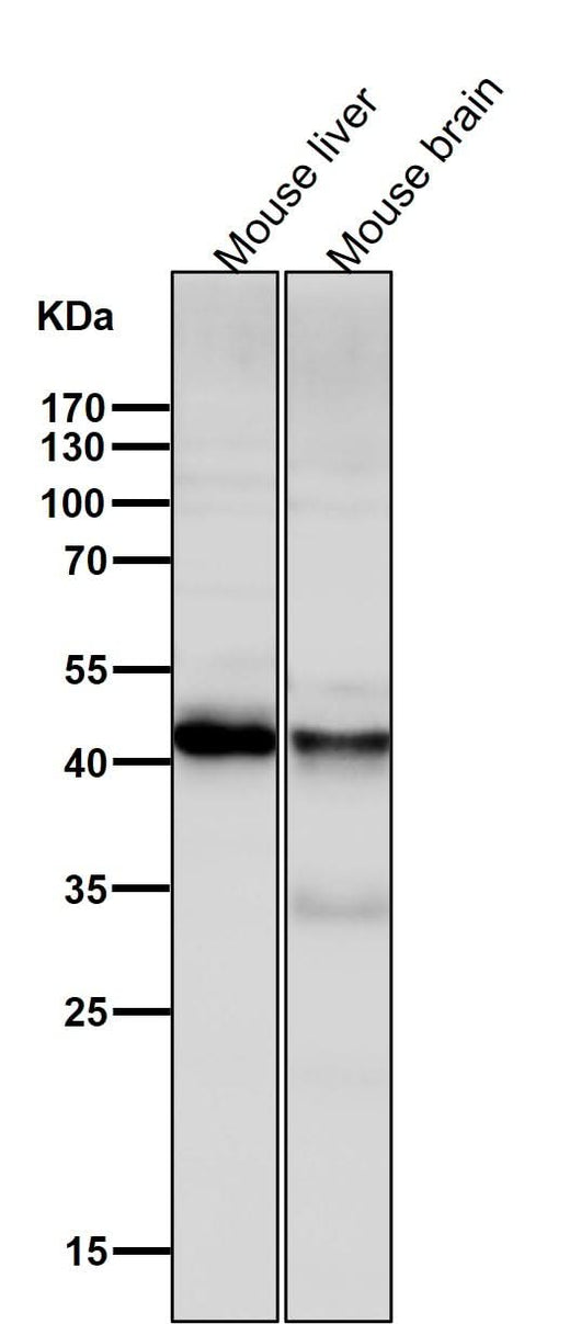 Anti-ALKBH1 Rabbit Monoclonal Antibody Boster Bio