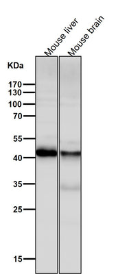 Anti-ALKBH1 Rabbit Monoclonal Antibody Boster Bio
