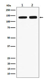 Anti-RNF40 Rabbit Monoclonal Antibody Boster Bio