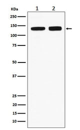Anti-RNF40 Rabbit Monoclonal Antibody Boster Bio