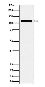 Anti-SEC24D Rabbit Monoclonal Antibody Boster Bio