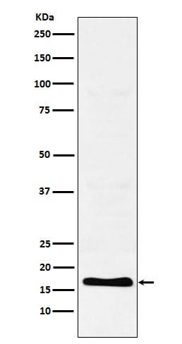 Anti-TFF2 Rabbit Monoclonal Antibody Boster Bio