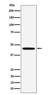Anti-MC5 Receptor Rabbit Monoclonal Antibody Boster Bio