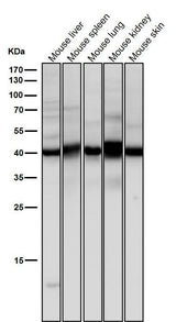 Anti-Erlin-2 Rabbit Monoclonal Antibody Boster Bio