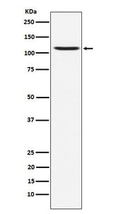 Anti-GluA4 Rabbit Monoclonal Antibody Boster Bio