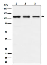 Anti-TAOK1 Rabbit Monoclonal Antibody Boster Bio